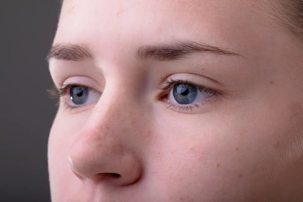 Central heterochromia