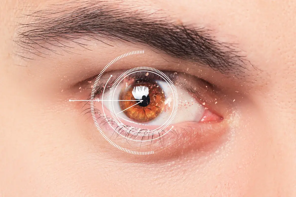 ciri-ciri retina mata bermasalah