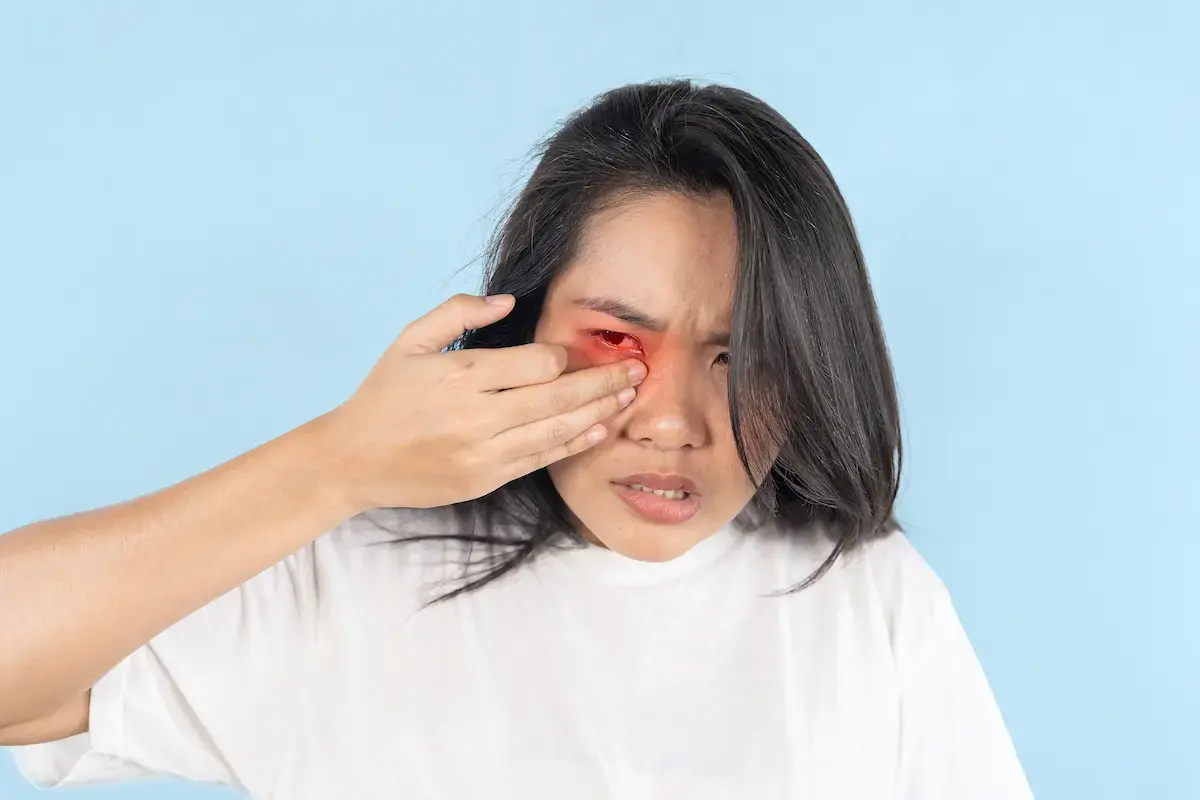 hot oil in the eye