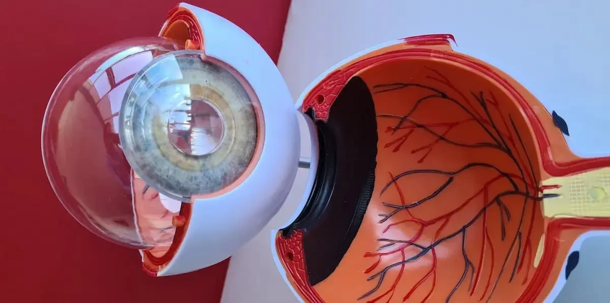 Posterior vitreous detachment