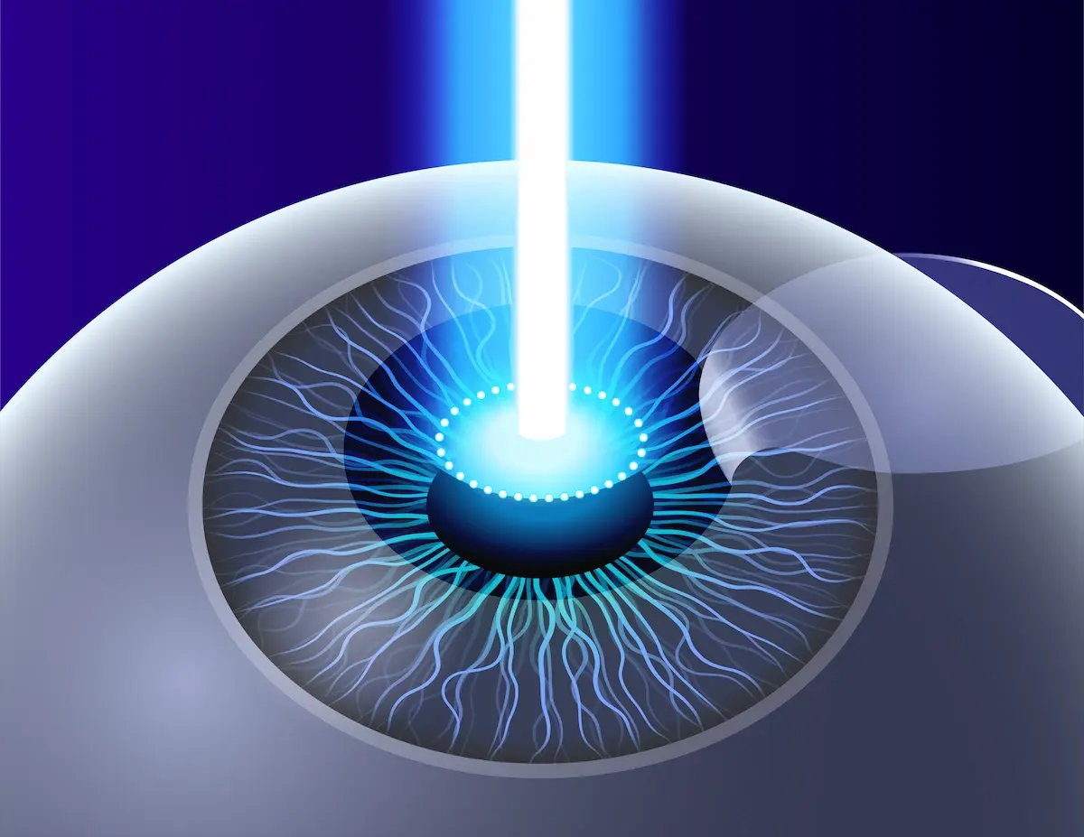 apakah lasik bisa pakai bpjs