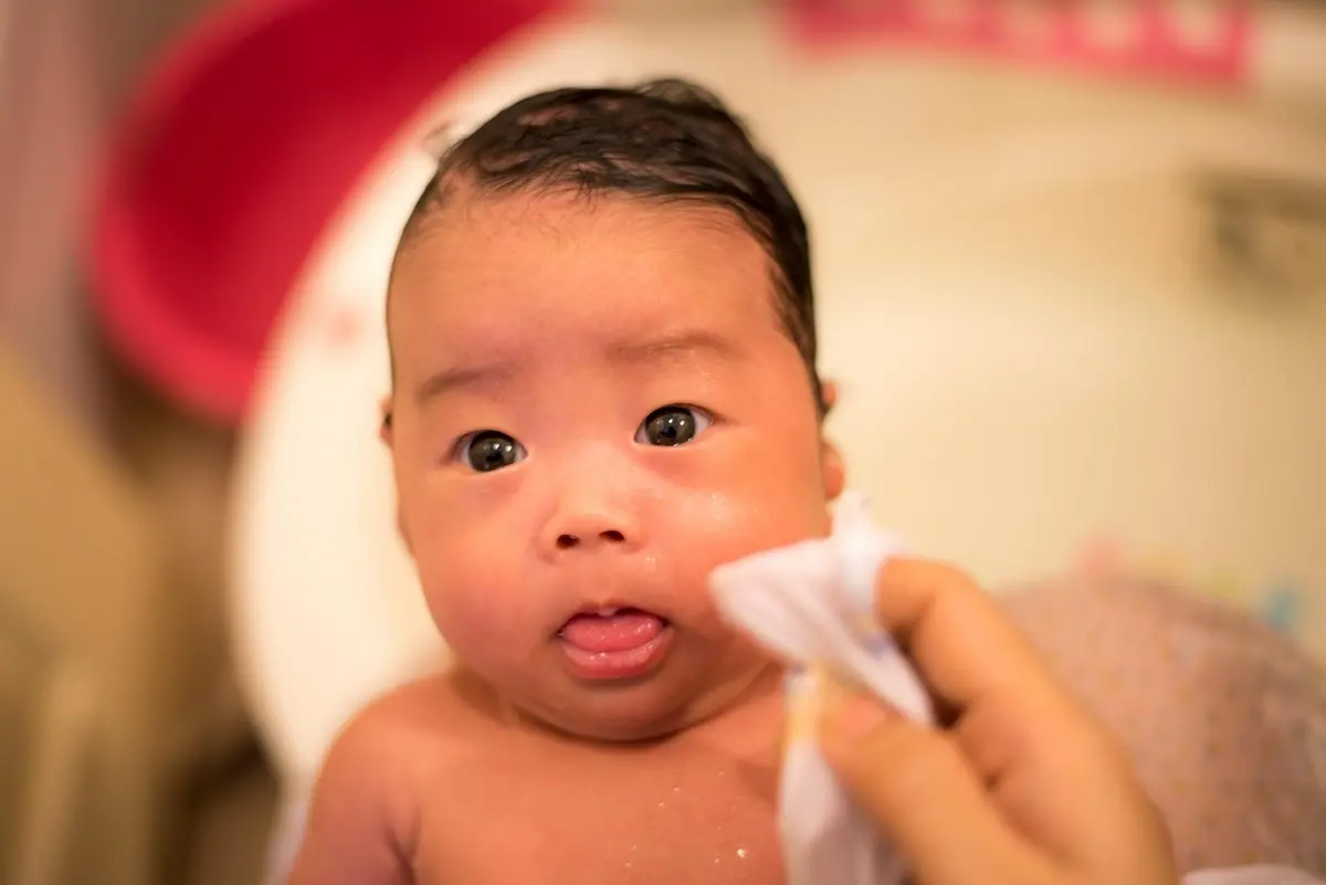 cara mengobati mata bayi belekan dan berair